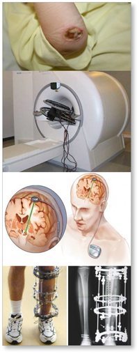 MRI Safety Images