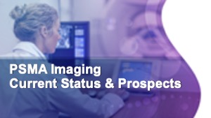 PSMA Imaging: Current Status & Prospects